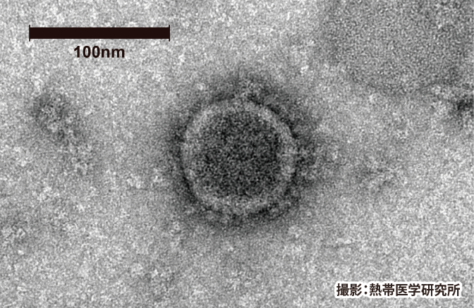 Image of the COVID-19 taken by electronic microscope